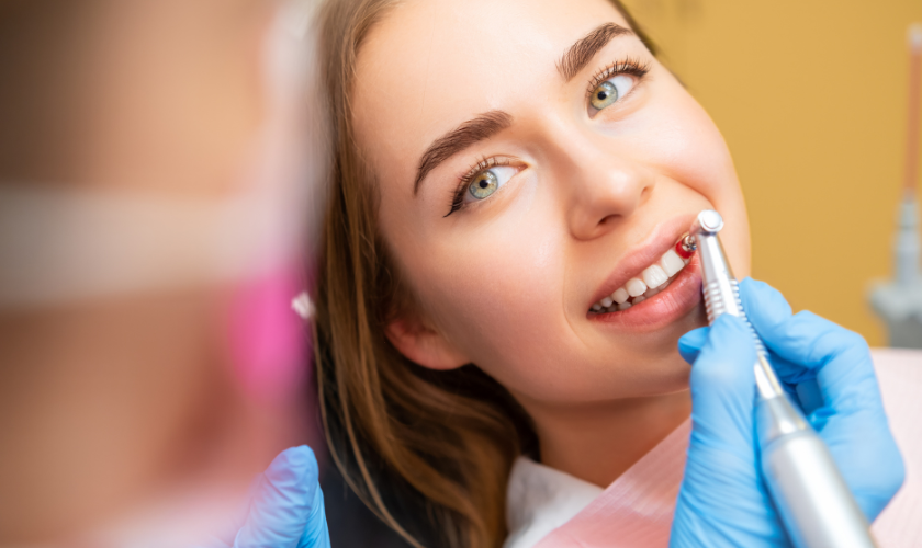 Understanding Veneers and Enamel Removal